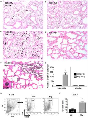 Studying the Effects of Granulocyte-Macrophage Colony-Stimulating Factor on Fetal Lung Macrophages During the Perinatal Period Using the Mouse Model